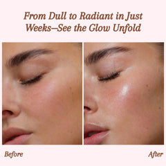 RevitaDerm™ — Unleash Radiant, Silky Skin and Banish Flaws for Good