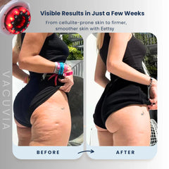 SculptiFirm™ — Tighten, Tone, and Glow with Effortless Skin Revival