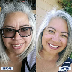 The Pro-Adaptive Dentures – Restore Your Smile, Enjoy Every Bite, and Live Confidently Again + 50% OFF