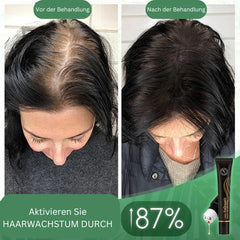 1+1 Free | FollicleFuel™ Boost Hair Growth