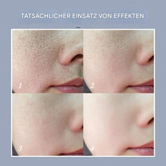 Instant Smoothing Face Primer Serum | Blurs Look of Fine Lines & Pores | Matte, Non-Greasy Finish | Makeup-Safe | Sensitive Skin