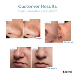 SkinClear™ Skin Renewal Therapy