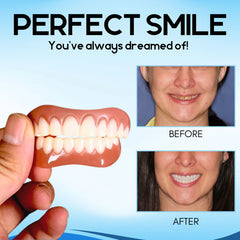 SmileFlex™ Instant Denture Fit