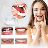 SnapDent™ Snap-On Dentures