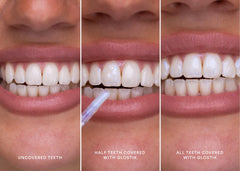 SmileGleam™ Smile Enhancing Gloss
