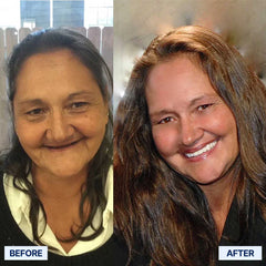 The Pro-Adaptive Dentures – Restore Your Smile, Enjoy Every Bite, and Live Confidently Again + 50% OFF