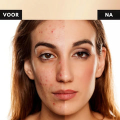 ToneFix™ Covers Imperfections Instantly