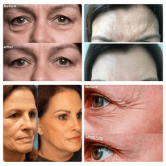 PerfectSync™ — Erase Fine Lines & Glow Naturally | 1+1 FREE Today