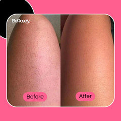 AquaScrub™ Gentle Exfoliation Power