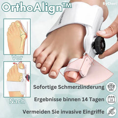 1+1 FREE FOR A LIMITED TIME | OrthoAlign™ – Big Toe Corrector