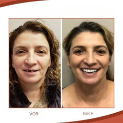 OrthoFix™ Smooth Dental Repair