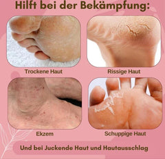 1+1 Free | SoleSerum™ Renew Heel Smoothness