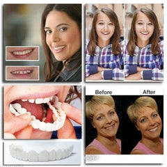 SmileSnap™ Comfort Fit Dentures