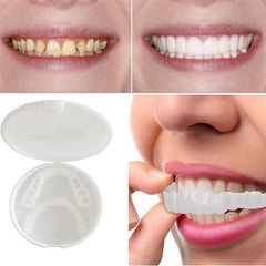 SmileSculpt™ — Unlock the Confidence of a Perfectly Natural, Head-Turning Smile
