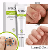 Nail Fungus Care Gel | Helps Improve Look of Discolored, Thick Nails | Fast-Absorbing, At-Home Use | 10-Min Apply