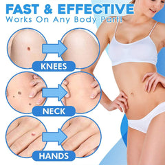 SkinPure™ Confidence Without Scars