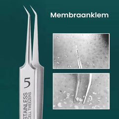 TweezeClear™ Targeted Blemish Extraction