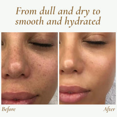 SkinPulse™ - Professional Ultrasonic Skin Cleansing