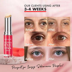 2+1 Free | EyeRevive™ Awaken Radiant Skin