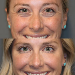 2+1 Free | EyeRevive™ Awaken Radiant Skin