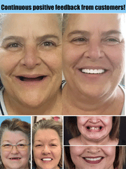 PureDent™ Ultimate Smile Restoration