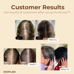 FollicleFix™ Thicker Healthier Hair