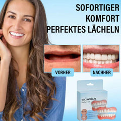 SmileFlex™ Instant Denture Fit