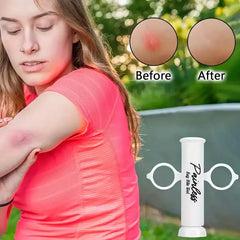 2+2 Free | BiteAway™ Instant Itch Relief