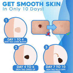 SkinPure™ Confidence Without Scars