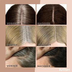 Buy 1 Get 1 Free - Limited Time Only | EasyBlend™ - Bye-Bye Hairline