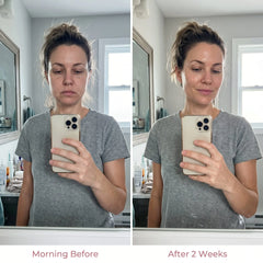 Facial Sculpting & De-Puffing Tool | 5-Min Daily Massage for Jawline & Cheeks | Gentle for All Skin Types | At-Home Routine