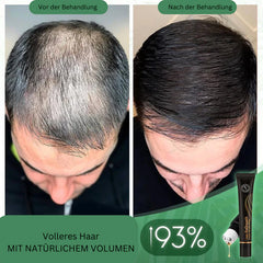 1+1 Free | FollicleFuel™ Boost Hair Growth