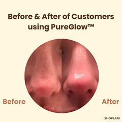 1+1 FREE | PureGlow™ - Black Tea Mask