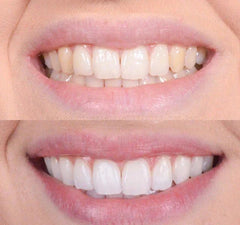 LuminiWhite™ — Unleash a Radiant, Pain-Free Smile That Turns Heads Instantly