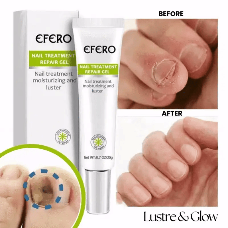Nail Fungus Care Gel | Helps Improve Look of Discolored, Thick Nails | Fast-Absorbing, At-Home Use | 10-Min Apply