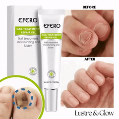 Nail Fungus Care Gel | Helps Improve Look of Discolored, Thick Nails | Fast-Absorbing, At-Home Use | 10-Min Apply