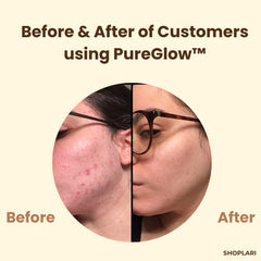 1+1 FREE | PureGlow™ - Black Tea Mask